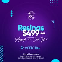 Prótesis dental
