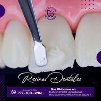 Procedimiento estético dental